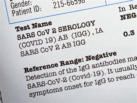 how to get a hard copy of covid test results|Coronavirus Disease (COVID.